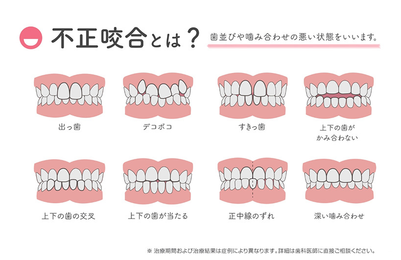 クリアコレクト